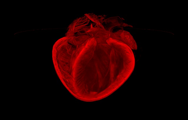 The human heart
