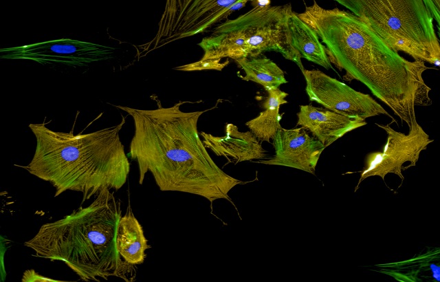 Heart stem cells grown in a lab