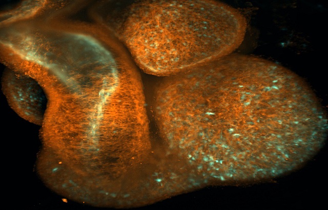 Mouse embryonic heart at 12.5 days of gestations