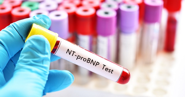 Common blood test to detect heart failure 