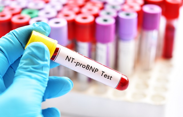 Common blood test to detect heart failure