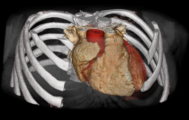 CT scan image