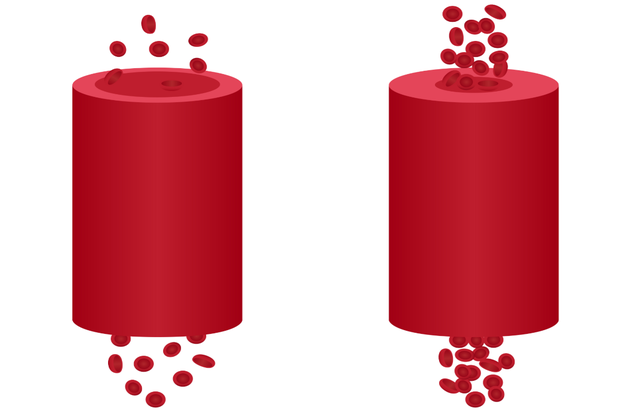 Blood cells moving through constricted blood vessel