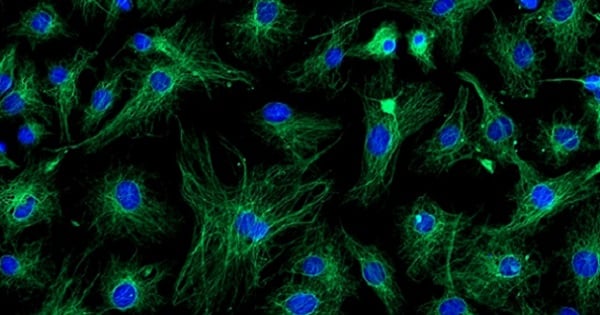 Image of zombie cells