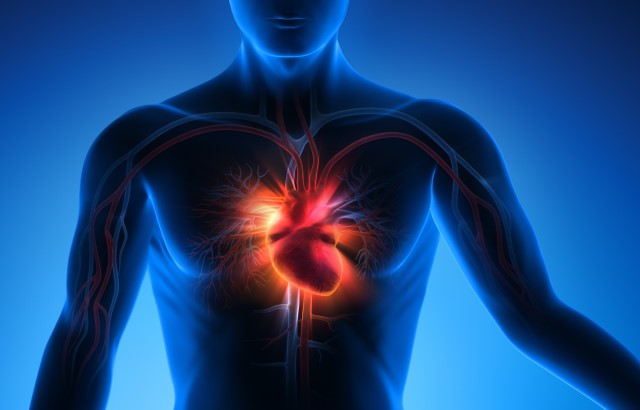 3D illustration of a heart attack