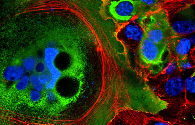 Fusion of coronavirus-infected cells