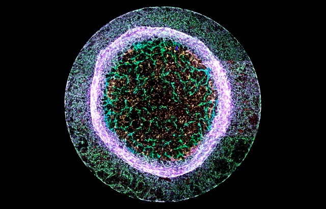 Blood vessels growing in gelatin