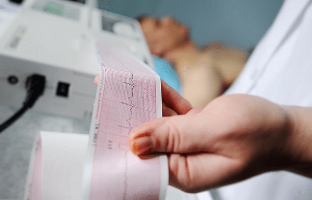 If Ecg is Normal Can You Still Have Heart Problems? Unveiling the Hidden Risks