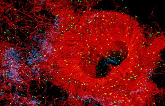 Winner of the BHF Reflections of Research image competition