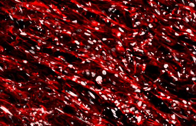 BHF scientist-produced image of waves of heart cells speckled with white nuclei, part of a beating heart patch grown in a dish.