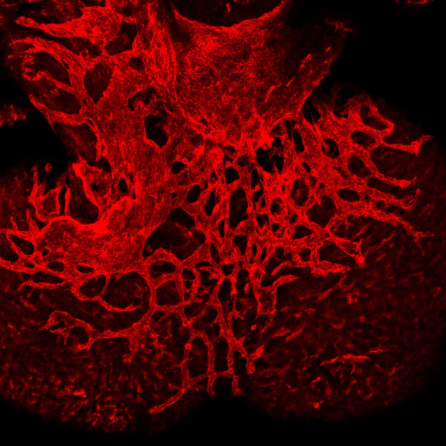 BHF scientist-produced image of the development of blood vessels on the outside surface of the heart, branching out in a red web.