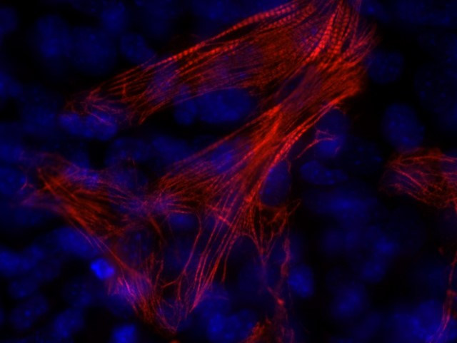 BHF research image of heart muscle grown from stem cells.