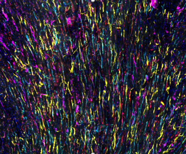 BHF research image of colourful streamers showing migrating cells on the inside of blood vessels.