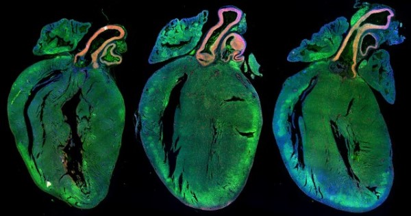 BHF research image of three glowing green hearts showing the effects of stimulating mouse hearts to regenerate.