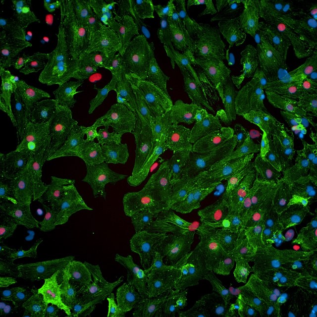 BHF research image of heart muscle cells stimulated by microRNAs to encourage multiplication.