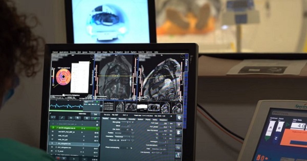 AI tool and MRI scan