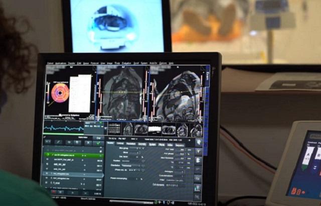 AI tool and MRI scan