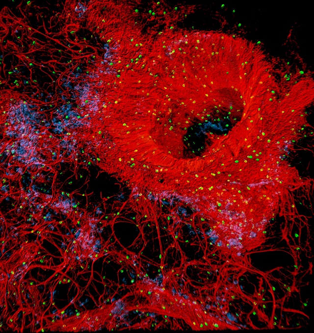 A flare of stellar vessels