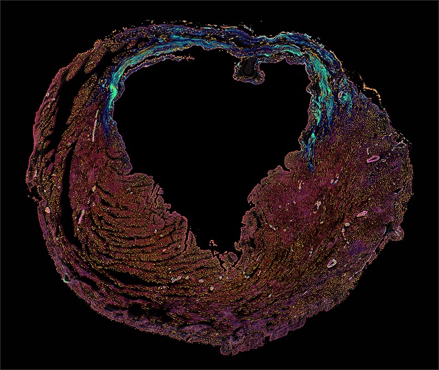 Heart within a heart