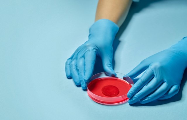 The Heart Healing Patch in a petri dish
