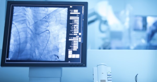 Photo with an Xray suite in the background and a computer screen showing a procedure in the foreground