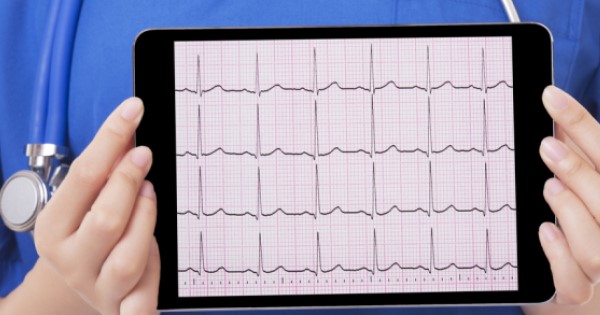 A doctor holds up an electrocardiogram (ECG) recording on a tablet