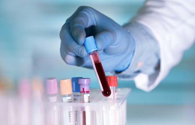 A researcher's gloved hand picks up a vial of blood in the lab