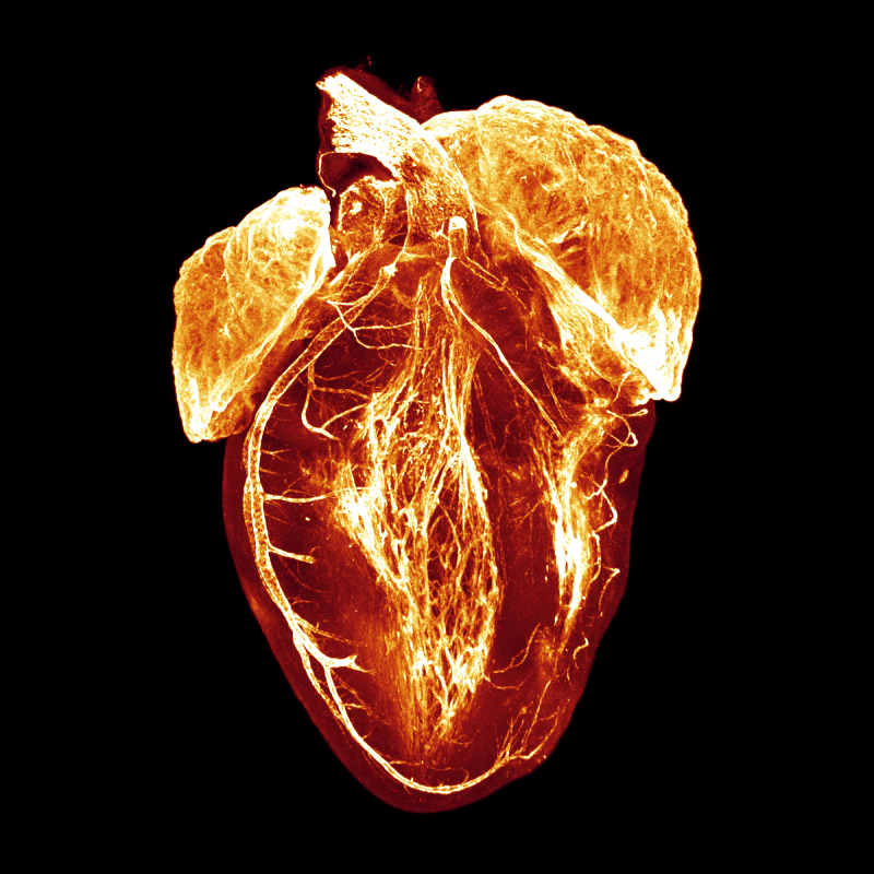 Judy Sayers' winning image, showing the electrical system of the heart illuminated