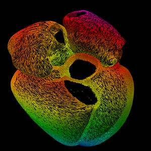 Marina Strocchi's winning image, mapping heart cell bundles that pass on the signal that causes the heart to contract