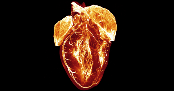The image shows a human heart that has been made transparent to expose the dedicated electrical system that dictates the heartbeat and organises the heart’s rhythmic contraction.  is visible as the tangle of fibres in the middle of the image. There are two glowing areas at the top of the heart – the atria, the top two chambers of the heart – and a branch around the outside on the left of the image - this is a coronary artery which supplies blood to the heart muscle. The image was taken by Judy Sayers, a researcher at the University of Oxford.