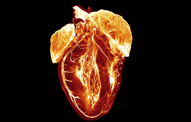 The image shows a human heart that has been made transparent to expose the dedicated electrical system that dictates the heartbeat and organises the heart’s rhythmic contraction.  is visible as the tangle of fibres in the middle of the image. There are two glowing areas at the top of the heart – the atria, the top two chambers of the heart – and a branch around the outside on the left of the image - this is a coronary artery which supplies blood to the heart muscle. The image was taken by Judy Sayers, a researcher at the University of Oxford.