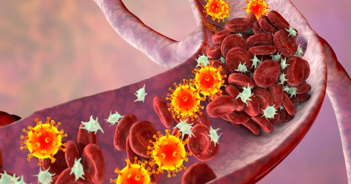 Stroke patients could benefit from earlier blood thinning treatment BHF