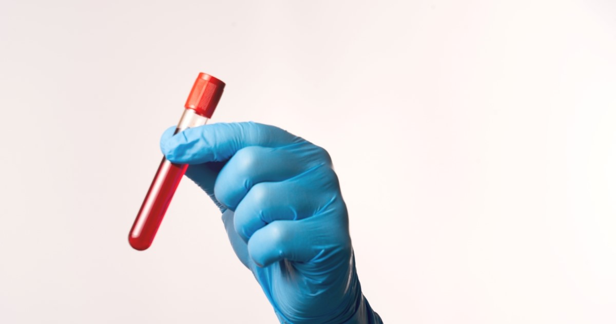 A hand in a blue glove holds a test tube with blood in it