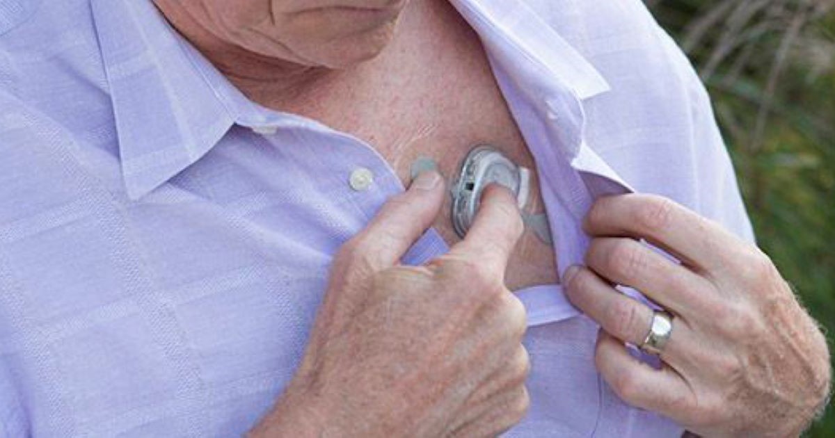 A man sticks the wearable patch used in the study onto his chest