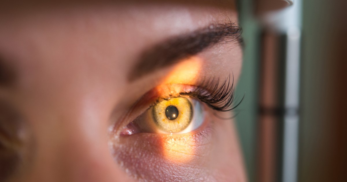 Photo zoomed in on someone's eye with a light shining onto it