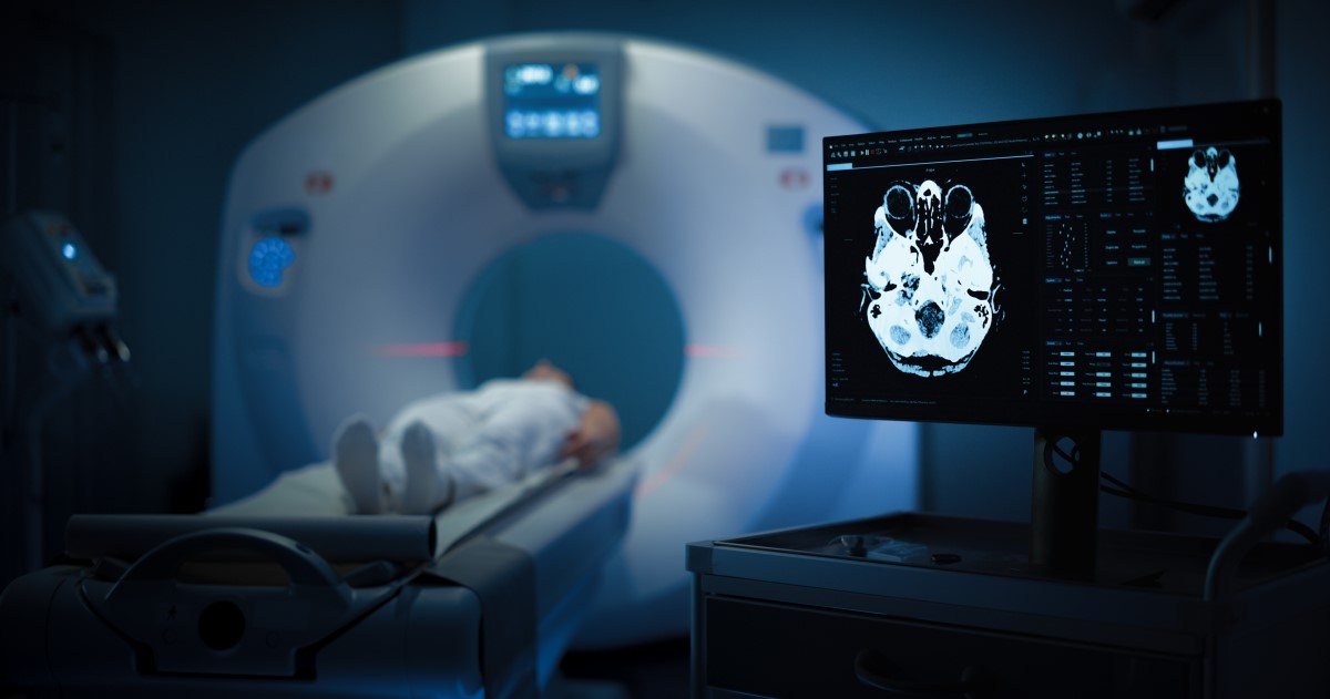 A person lies in an MRI scanner and a computer screen shows a scan image