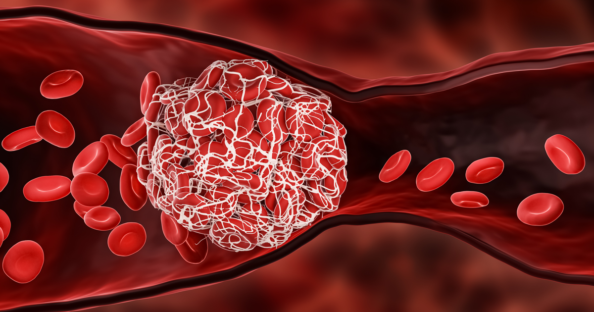 Illustration of blood clotting