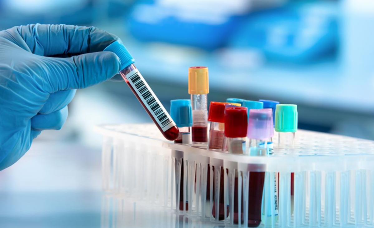 Researcher taking out a test tube from a test tube holder