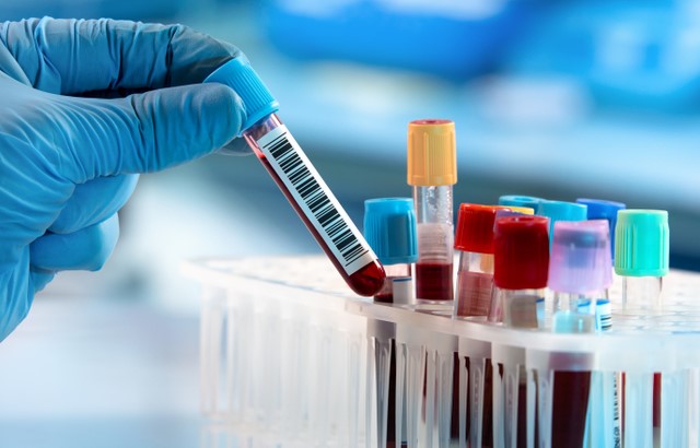 Researcher taking out a test tube from a test tube holder