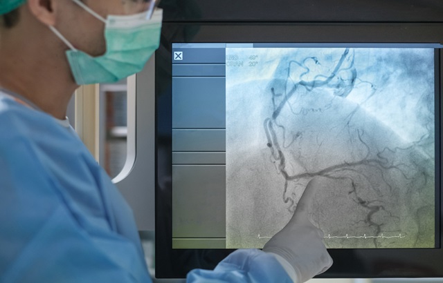 Dr looking at a heart scan image 