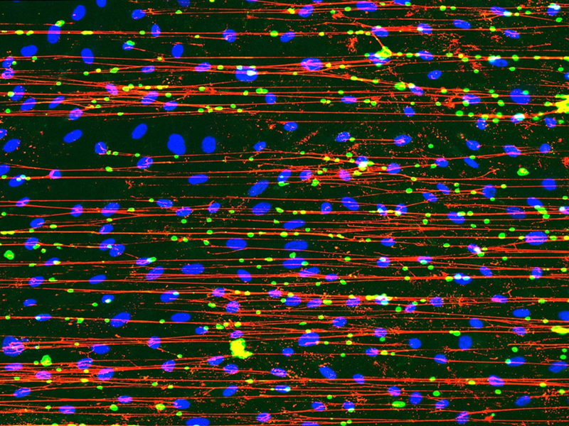 Red protein strings creating a net to catch blue sticky cells, called platelets, that help heal broken blood vessels