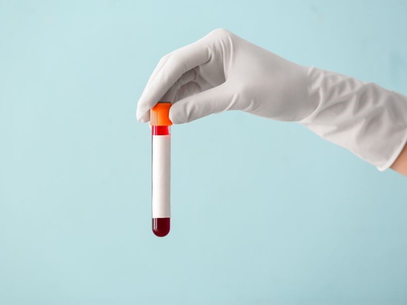 hand holding a test tube for a blood test