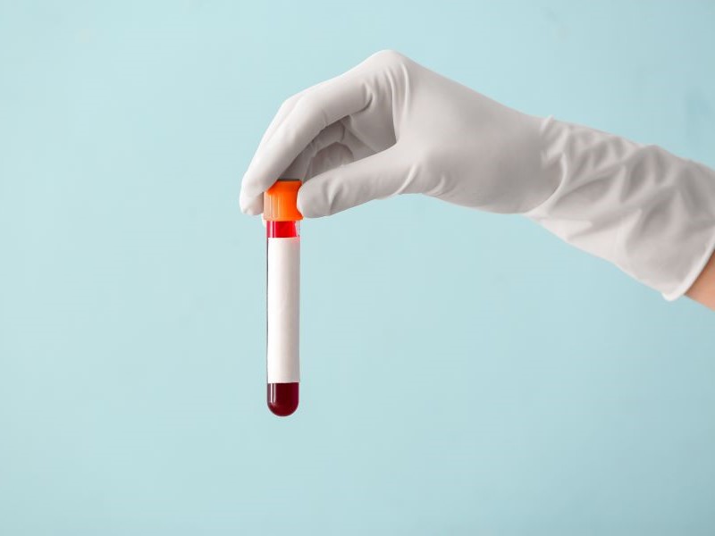 hand holding a test tube for a blood test