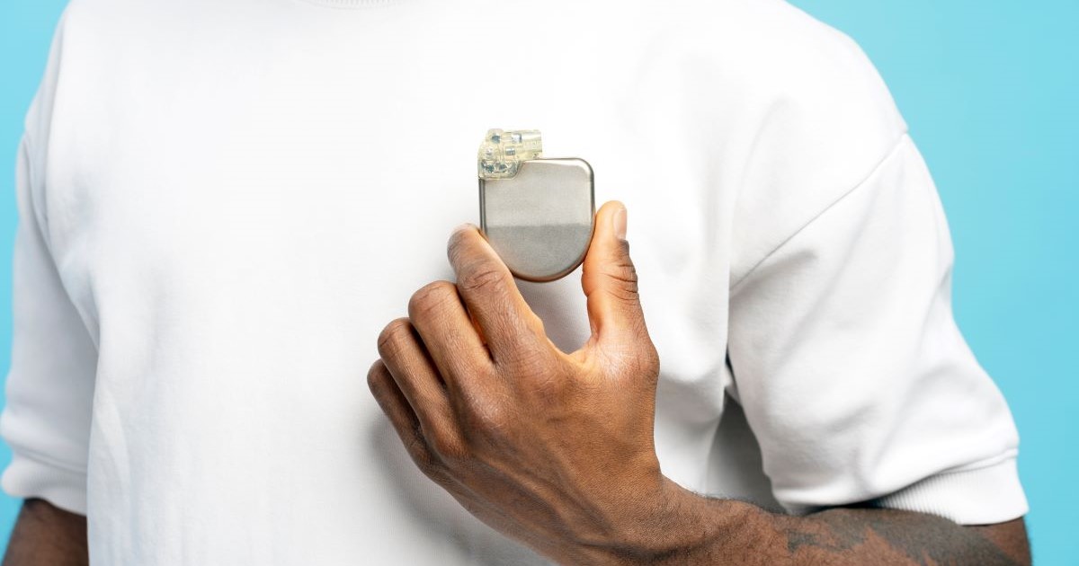 Man in a white T-shirt holding a pacemaker