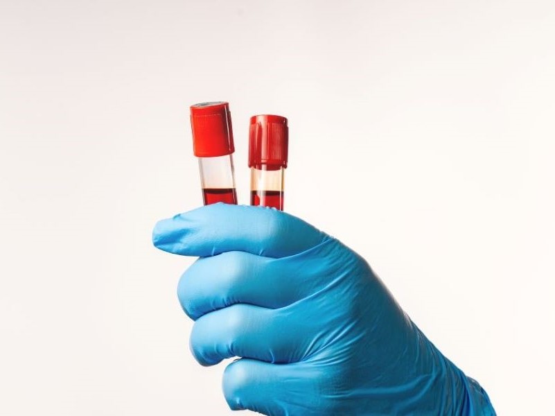 A gloved hand holds a test tube of blood