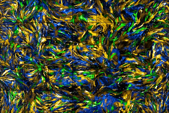 Smooth muscle cells surrounding blood vessels