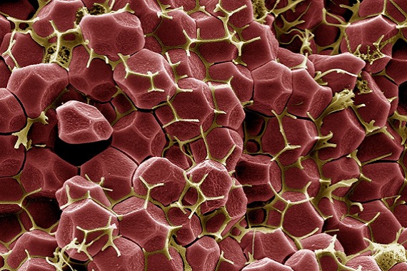 Internal structure of a blood clot