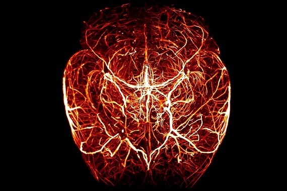 Network of blood vessels in the mouse brain
