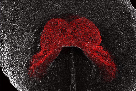 Heart in a developing mouse embryo