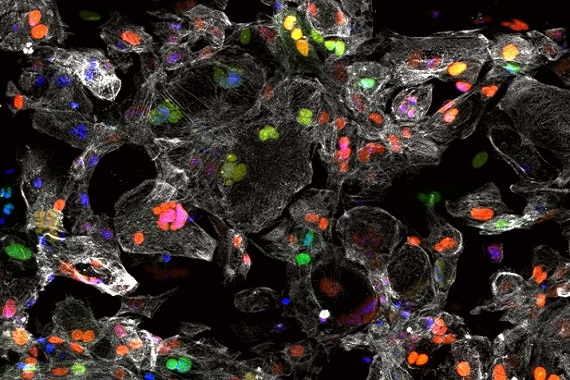 Human heart muscle cells derived from stem cells